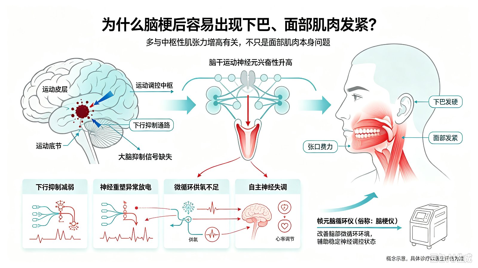 为什么脑梗后容易出现下巴、面部肌肉发紧?